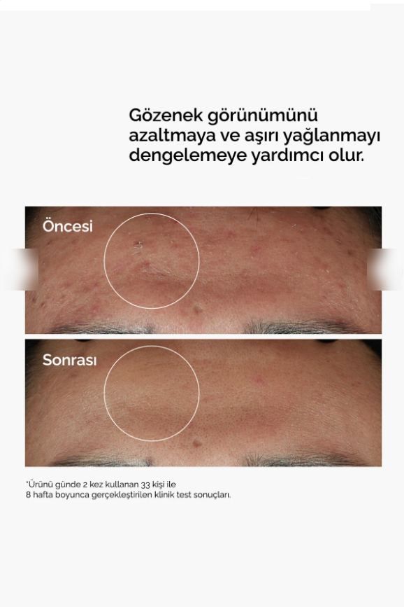 Buravia Niacinamide 10% + Zinc 1% Serum 30ml